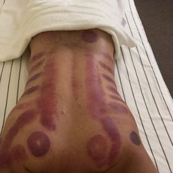 Cozy Spa - Cupping + Deep Tissue Massage