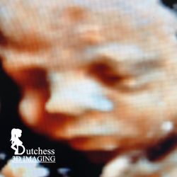 Dutchess 3D Imaging
