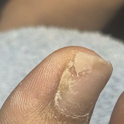 Image Nails