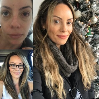 Mosaic Eye Specialists - Read my detailed experience with Dr Dao and his whole team. I'm so grateful. 20/15 vision. PRK. - Ophthalmologists Near Me - San Diego, California