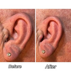 Wildly Aesthetics - Ear wax