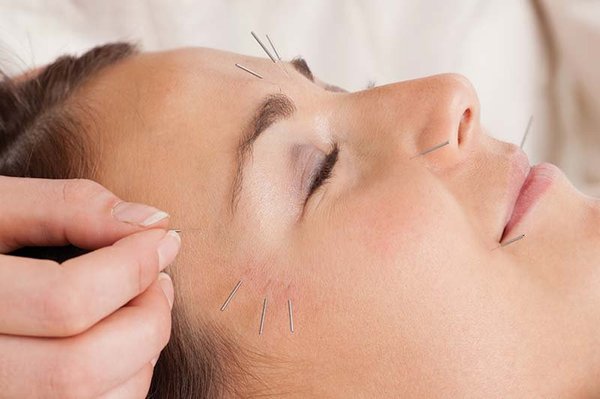 ACA ACUPUNCTURE & WELLNESS - COLUMBUS CIRCLE - Updated July 2026 - 27 ...