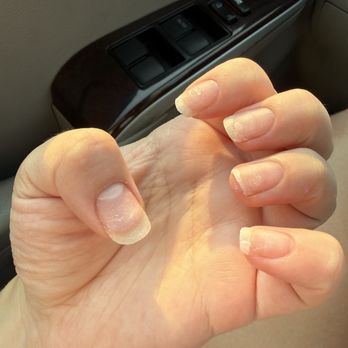 Nail Spa - Nails after nail removal - Nail Salons Near Me - Kent, Washington Nail Spa - Nails after nail removal - Nail Salons Near Me - Kent, Washington