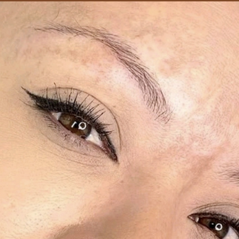 Skinversity - Skin Care Near Me - Chicago, Illinois Skinversity - Skin Care Near Me - Chicago, Illinois