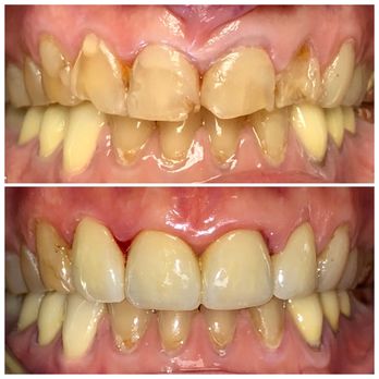 CASTRO VALLEY FAMILY DENTISTRY - Updated August 2025 - 25