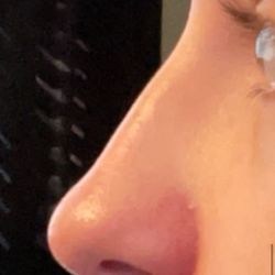 CraftMD - Plastic Surgery and Med Spa