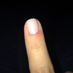 Red, sore, and bloody :( Red, sore, and bloody :(
