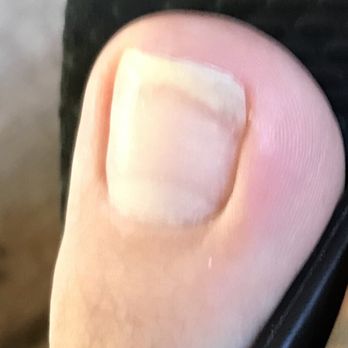T Nails & Spa - Infected on right side - Nail Salons Near Me - Newnan, Georgia T Nails & Spa - Infected on right side - Nail Salons Near Me - Newnan, Georgia