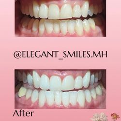 Elegant Smiles