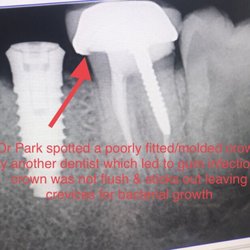 All County Endodontics