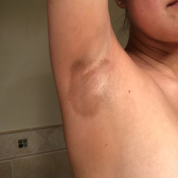 Bless Threading N Beauty Spa- Castro Valley - These huge stains in my armpits that won't come off. I spray tan regularly elsewhere and this has never once happened before. - Skin Care Near Me - Castro Valley, California Bless Threading N Beauty Spa- Castro Valley - These huge stains in my armpits that won't come off. I spray tan regularly elsewhere and this has never once happened before. - Skin Care Near Me - Castro Valley, California