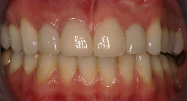 Yi Jay - Kensington Dental Designs