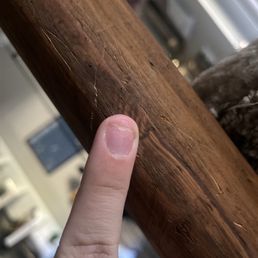 Update on 9/17. Top part of nail has fallen off.