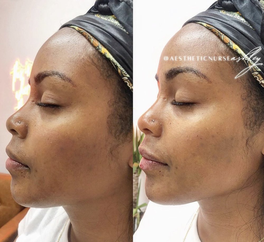 Aesthetic Nurse Ashley | Aluma Medical Logo