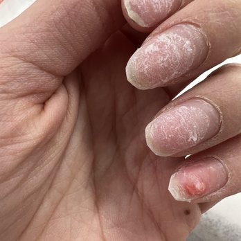 K3 Nails And Spa - Pinky was bleeding - Nail Salons Near Me - Milpitas, California K3 Nails And Spa - Pinky was bleeding - Nail Salons Near Me - Milpitas, California