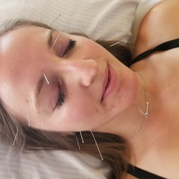 Sherri Martinez Physical Therapy & Wellness - Dry Needling can help with acute and chronic pain in the neck, back and joints, headaches, sports injuries, muscle strains and joints. - Physical Therapy Near Me - Bozeman, Montana Sherri Martinez Physical Therapy & Wellness - Dry Needling can help with acute and chronic pain in the neck, back and joints, headaches, sports injuries, muscle strains and joints. - Physical Therapy Near Me - Bozeman, Montana