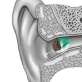 Total Hearing Care - Hearing Aid Providers Near Me - Tucson, Arizona Total Hearing Care - Hearing Aid Providers Near Me - Tucson, Arizona