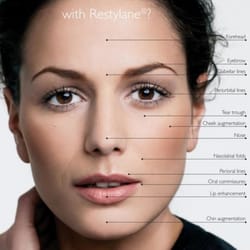 Dr WW Med Spa & Laser Center - What can be treated with Restylane?