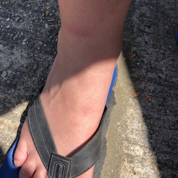 Journey Church - Injury on foot and ankle - Churches Near Me - Pineville, Louisiana