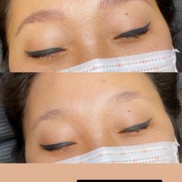 Right after my initial appointment. Right after my initial appointment.