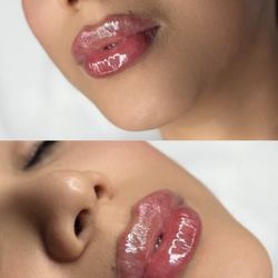 Joanna Injects Aesthetics