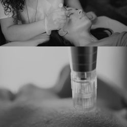 Azita Moallef Healing Arts - Microneeding