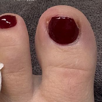 YOLO NAILS - The tech, who I've never seen before did not introduce herself and literally cut the corners of my big toenails. - Waxing Near Me - Basehor, Kansas YOLO NAILS - The tech, who I've never seen before did not introduce herself and literally cut the corners of my big toenails. - Waxing Near Me - Basehor, Kansas