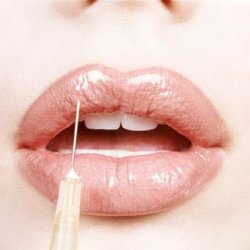 MiracleFace MedSpa - Lips Augmentation
