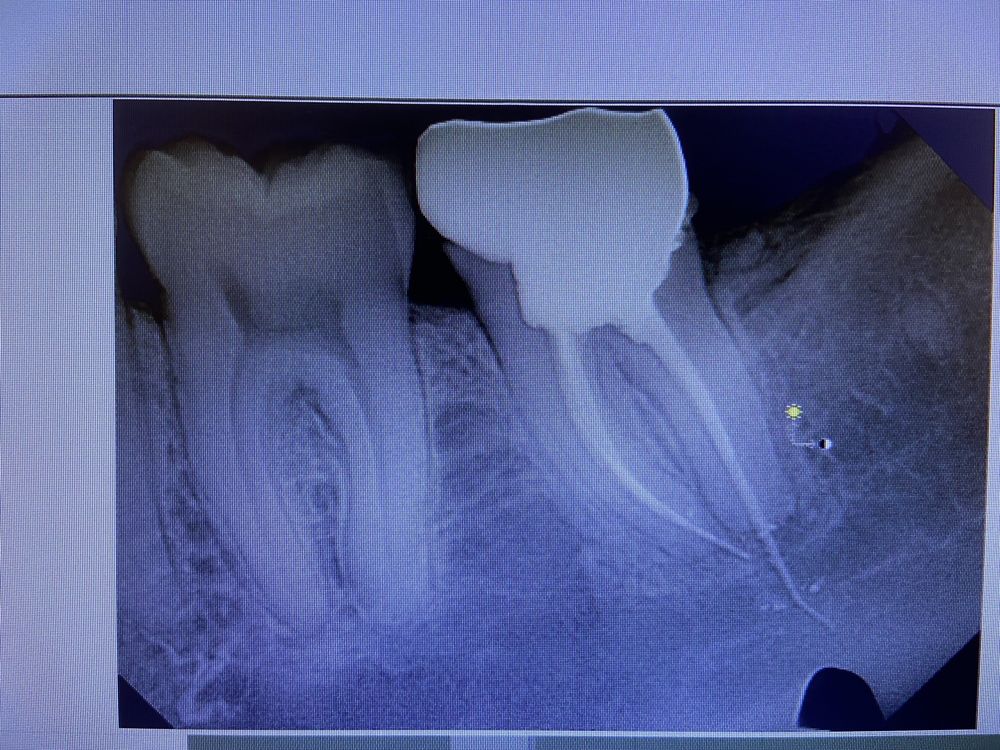 MONTANO FAMILY DENTISTRY Updated October 2024 10056 E Rosecrans Ave