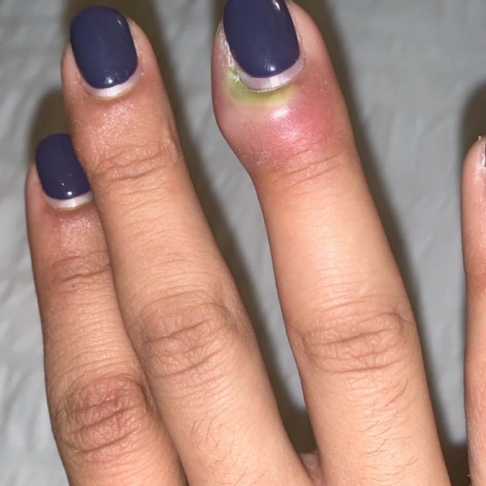 M54 Nails - Infection - Nail Salons Near Me - Washington, DC, District of Columbia M54 Nails - Infection - Nail Salons Near Me - Washington, DC, District of Columbia