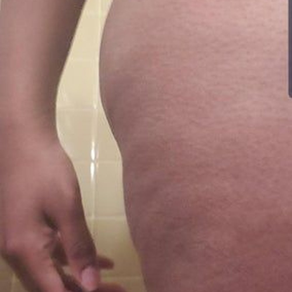 New Life Plastic Surgery - Cosmetic Surgeons Near Me - Miami, Florida New Life Plastic Surgery - Cosmetic Surgeons Near Me - Miami, Florida