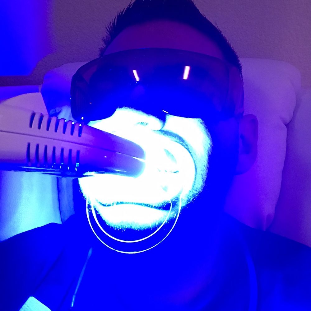 Illumination Teeth Whitening - The process - Teeth Whitening Near Me - Diamond Bar , California