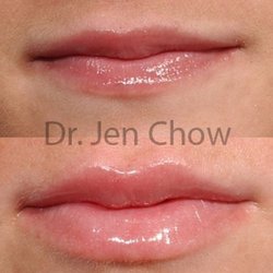 Jen Chow, MD