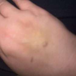 Dntl Surgery
