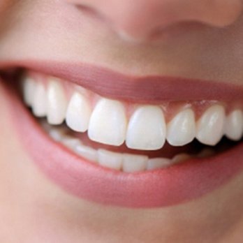 Gloria McMenamin, DDS - Whiter Smiles at Towson Dental! - General Dentistry Near Me - Towson, Maryland Gloria McMenamin, DDS - Whiter Smiles at Towson Dental! - General Dentistry Near Me - Towson, Maryland
