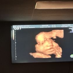 Prenatal Peek - Baby girl at 31 weeks