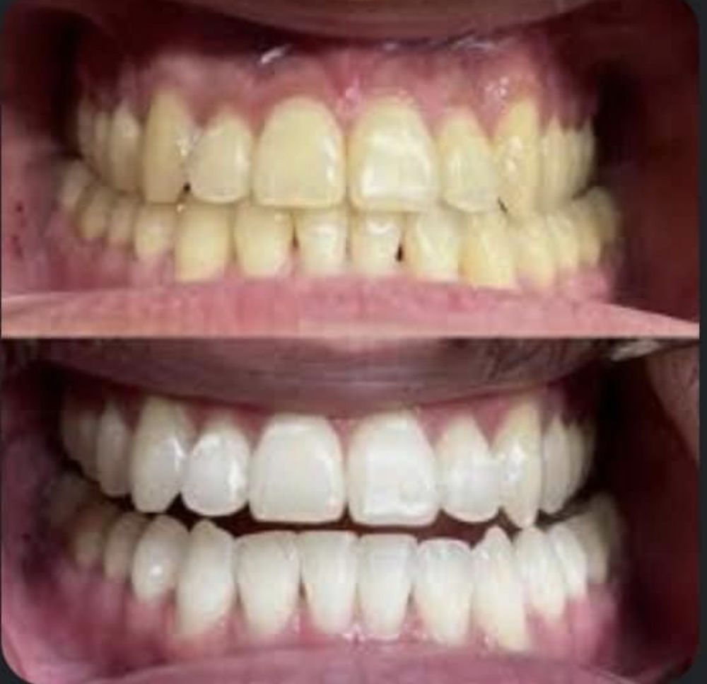 Exquisite Smiles Logo