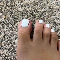 The toe that was cut, I should have took pictures of when it kept bleeding but I was just so pissed off The toe that was cut, I should have took pictures of when it kept bleeding but I was just so pissed off 