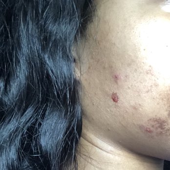 Massage Envy - A couple days after (how I went to the bridal shower) - Massage Near Me - Mansfield, Texas Massage Envy - A couple days after (how I went to the bridal shower) - Massage Near Me - Mansfield, Texas