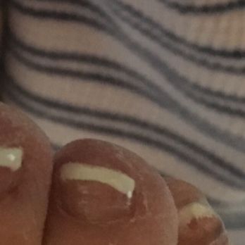 Long Beach Nails & Spa - Terrible job on my moms pedicure - Nail Salons Near Me - Long Beach, California Long Beach Nails & Spa - Terrible job on my moms pedicure - Nail Salons Near Me - Long Beach, California