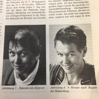 Dr. Kleanthous Kosmetik - Before and after from magazine - Cosmetics & Beauty Supply Near Me - St. Leon-Rot, BW
