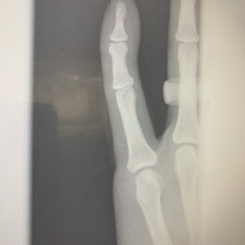 Healthpointe - Confirming it was removed. - Physical Therapy Near Me - Colton, California Healthpointe - Confirming it was removed. - Physical Therapy Near Me - Colton, California