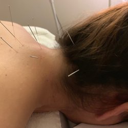 April Bui Acupuncture Clinic Houston