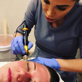 Gr8 Skin - MicroNeedling Treatment - Waxing Near Me - Scottsdale, Arizona Gr8 Skin - MicroNeedling Treatment - Waxing Near Me - Scottsdale, Arizona