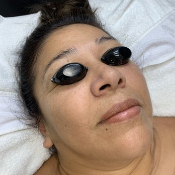 Radiant Skincare By Michelle - Befoe - Skin Care Near Me - Placentia, California Radiant Skincare By Michelle - Befoe - Skin Care Near Me - Placentia, California
