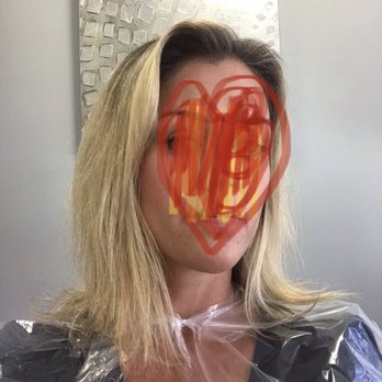 Beauty Studio by Veronica - Before shot - Skin Care Near Me - North Palm Beach, Florida