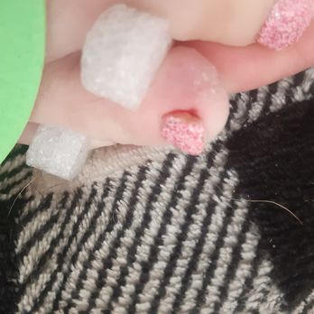 The Nails Bar - Bloody toe from being cut!!! - Nail Salons Near Me - El Paso, Texas The Nails Bar - Bloody toe from being cut!!! - Nail Salons Near Me - El Paso, Texas