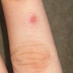 The drilled off skin from taking the nail polish off