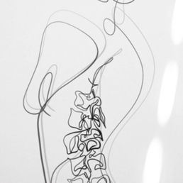 Disc Herniation Spinal Sketch