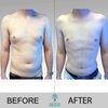 Liposuction Center Moein Surgical Arts gift card